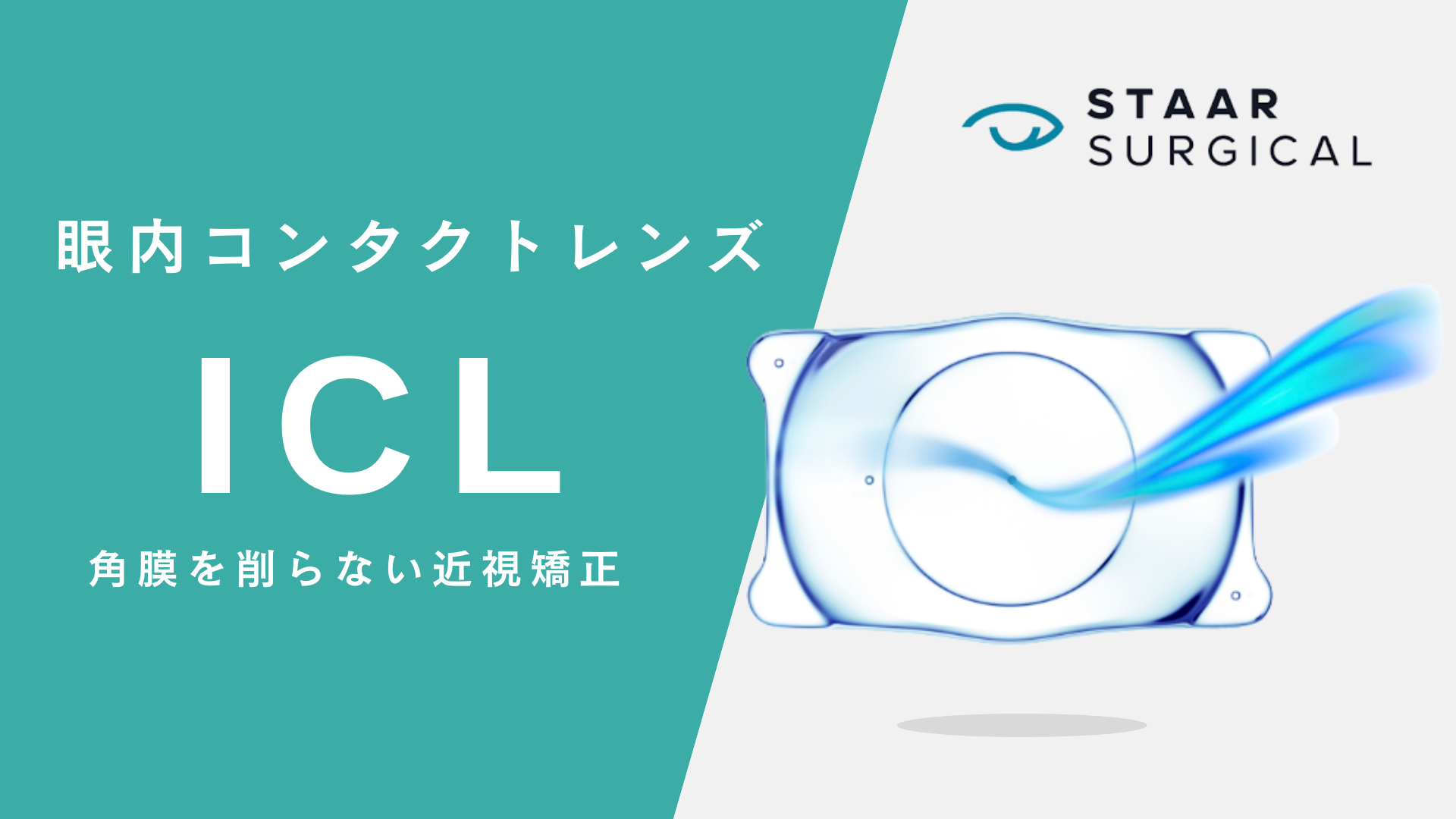 グラッシュビスタとは