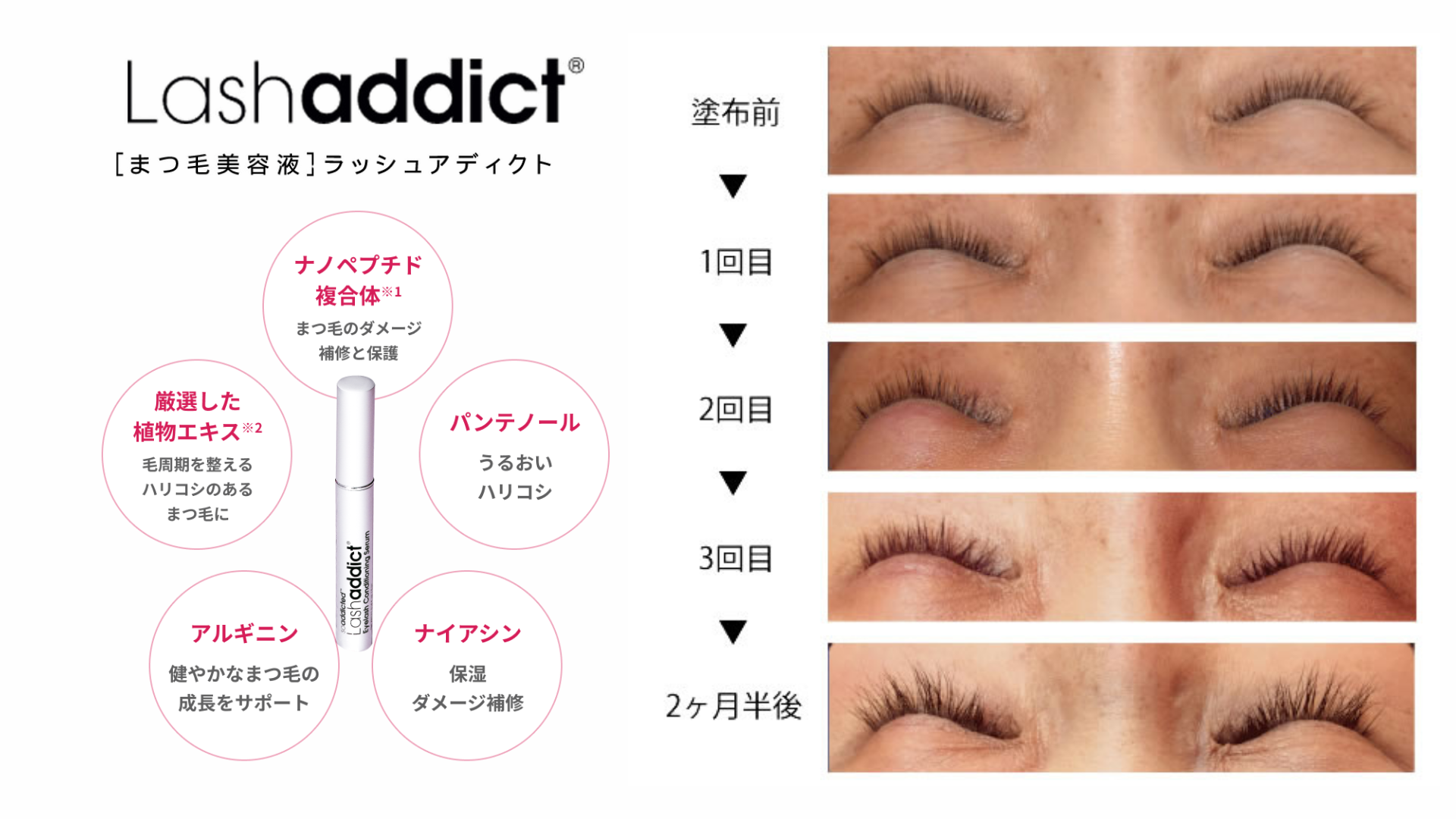 グラッシュビスタとは
