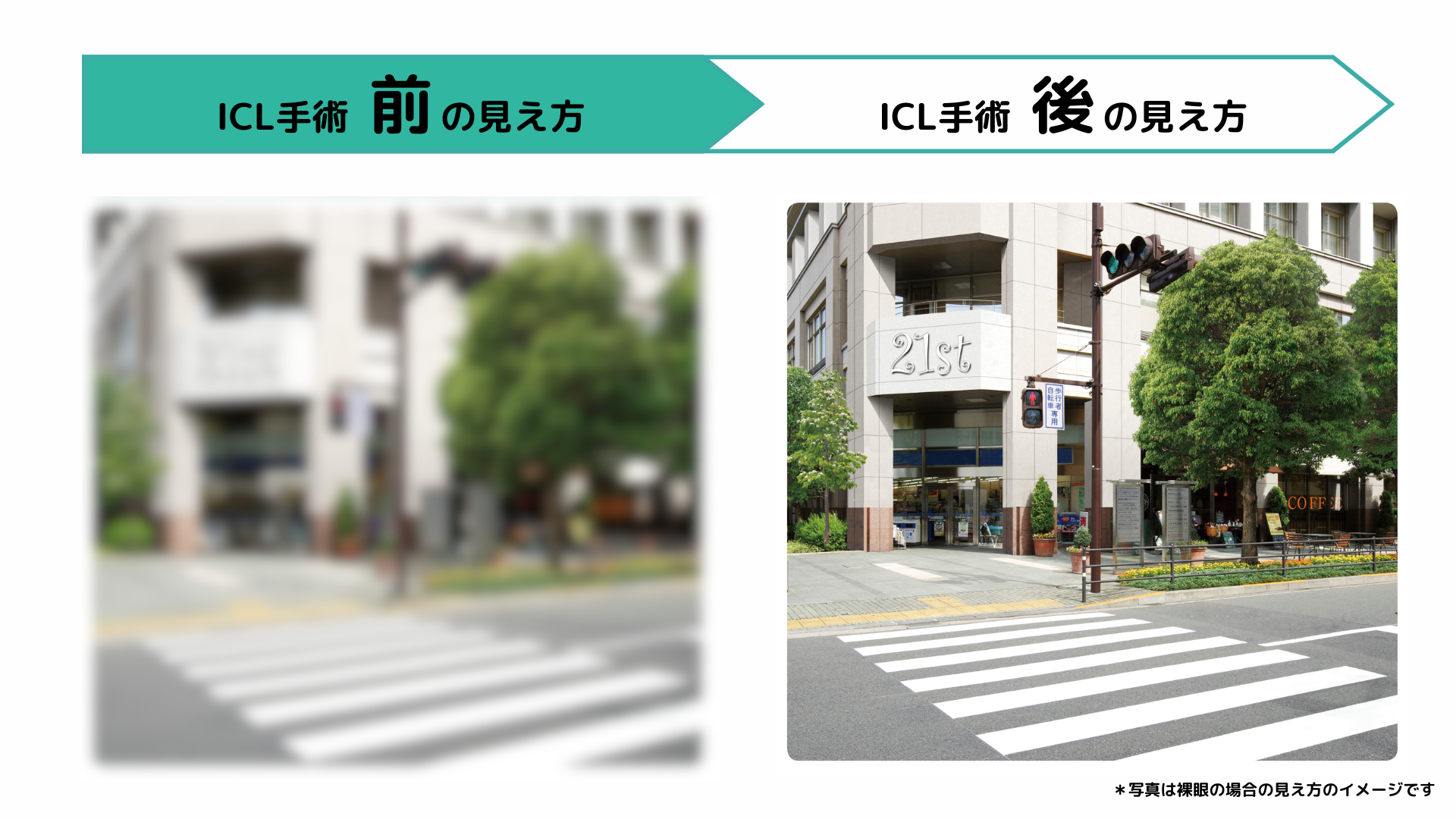 ICLの見え方