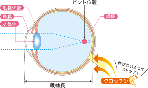 クロセチンによる近視抑制効果